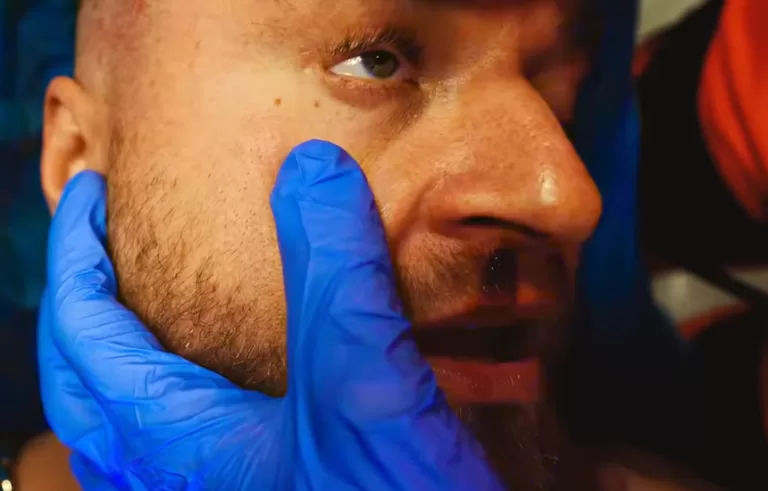 Książę Kapota koks