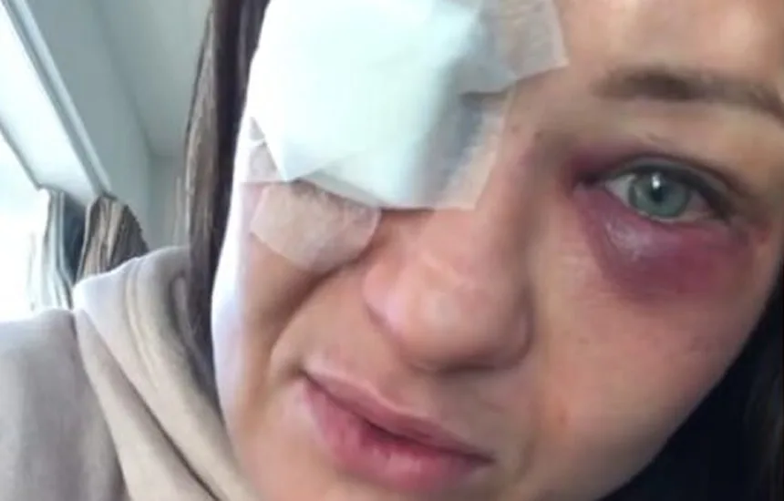 Karoliny Kowalkiewicz wzrok