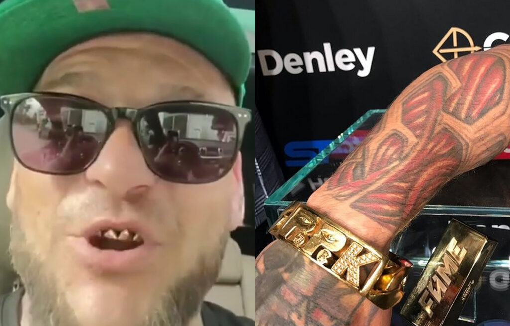 Popek złamał rękę