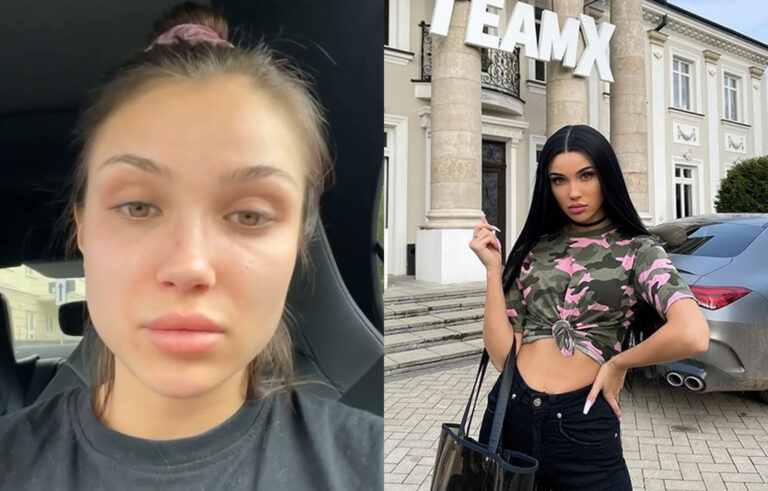 Natsu na temat afery