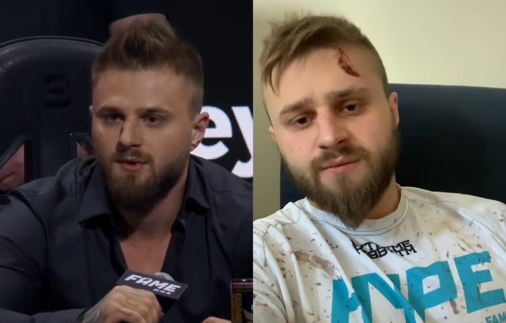 Amadeusz Ferrari maczety