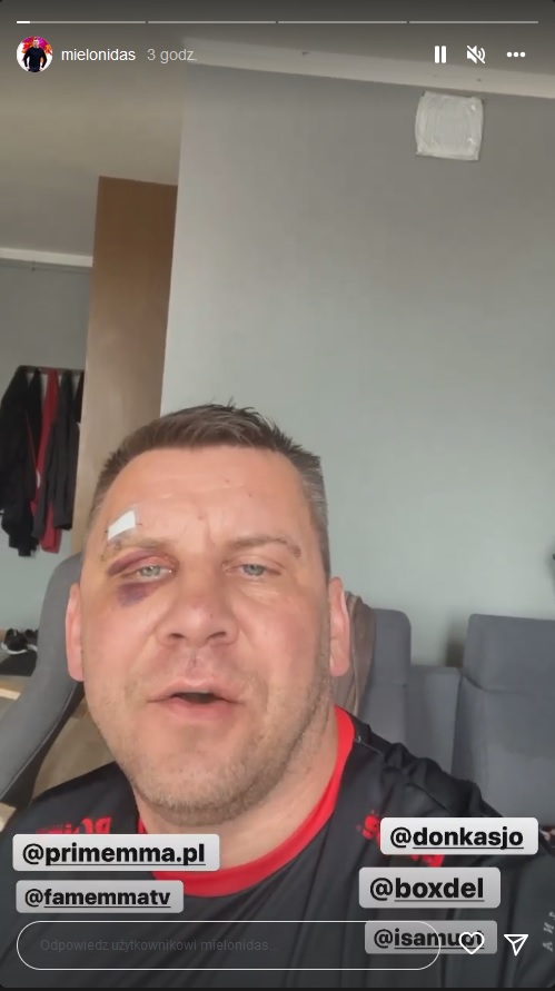 Mielonidas wyzywa Boxdela