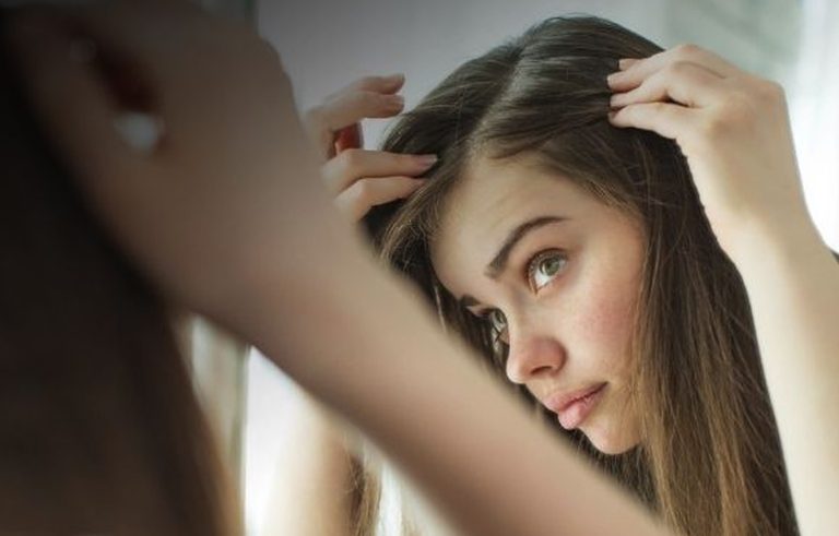 Jak wyleczyć łysienie telogenowe