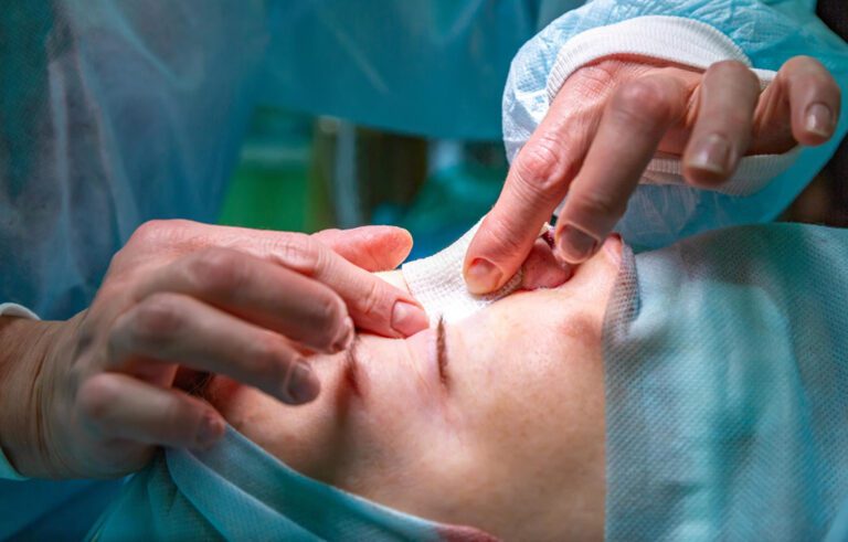 operacja septoplastyki