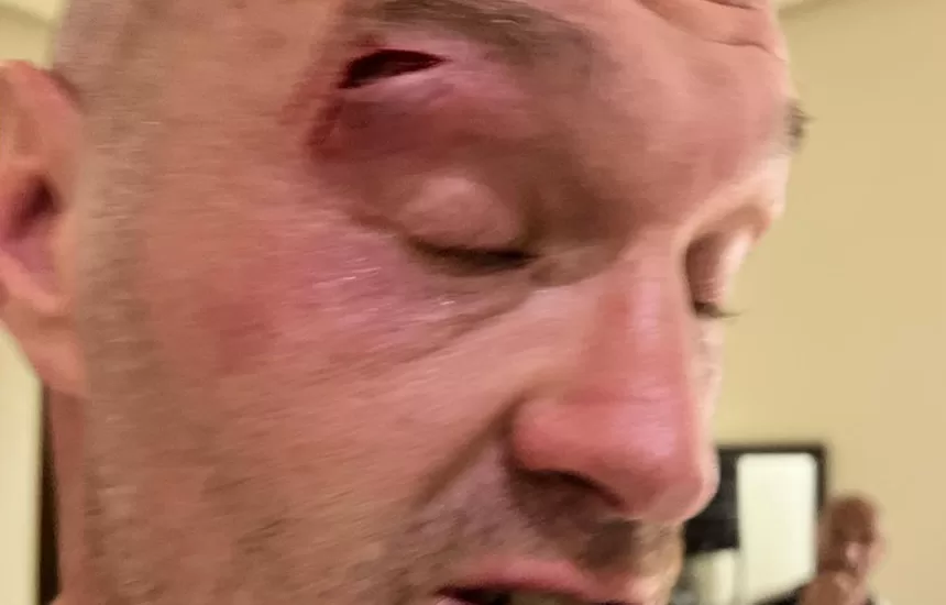 Fury Usyk oświadczenie